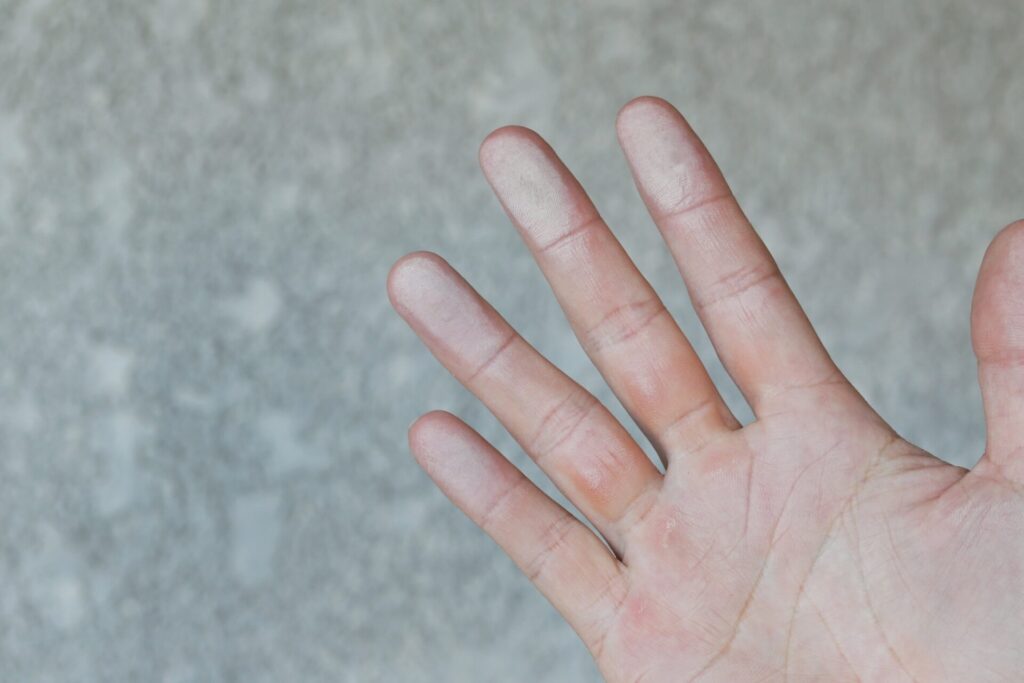 外壁のチョーキング